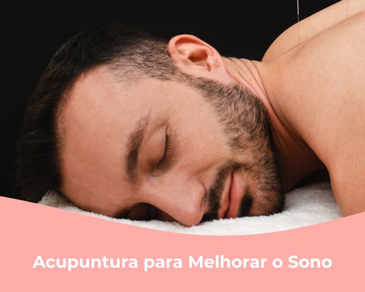 Acupuntura para Melhorar o Sono