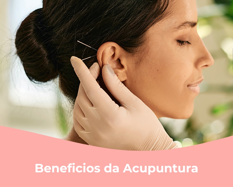 Beneficios da Acupuntura